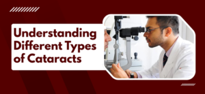 What Are the Different Types of Cataracts?