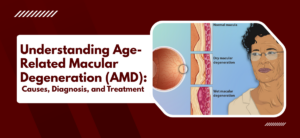 Understanding Age-Related Macular Degeneration (AMD): Causes, Diagnosis, and Treatment