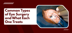 Common Types of Eye Surgery and What Each One Treats