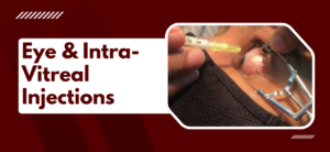 Eye & Intra-Vitreal Injections