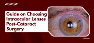 Guide on Choosing Intraocular Lenses Post-Cataract Surgery