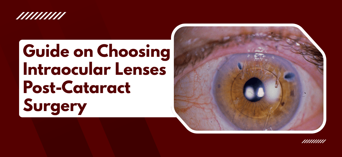 Choosing Intraocular Lens After Cataract Surgery | Claritas