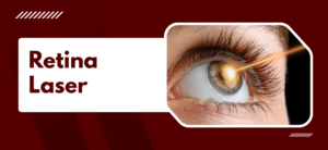 Retina Laser