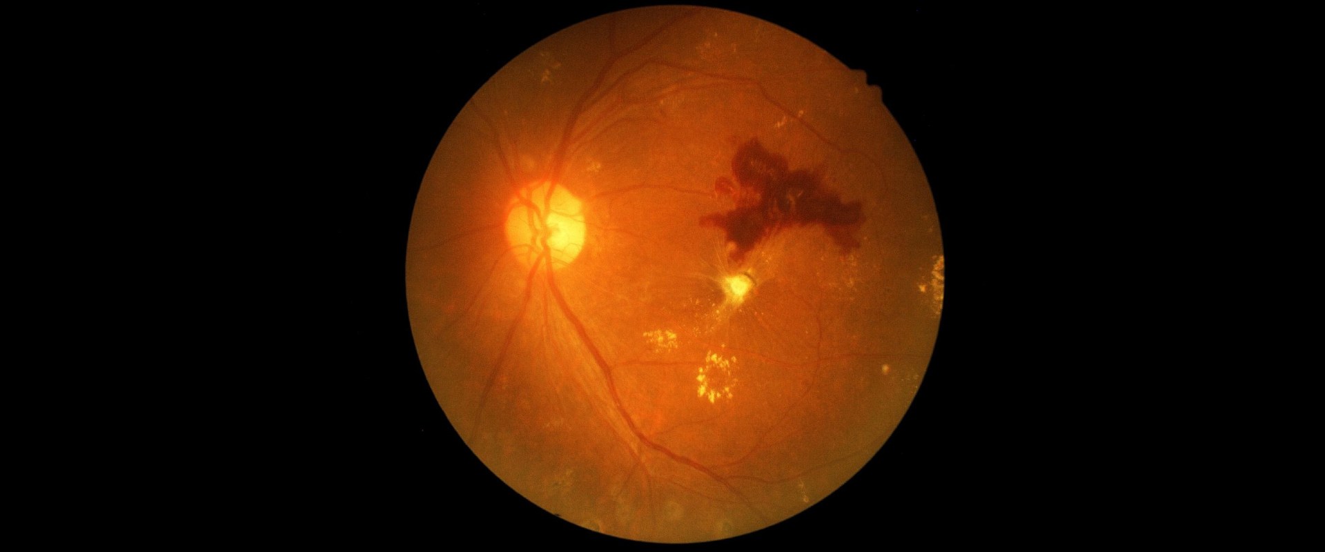 doctor checking patient’s retina