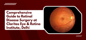 Comprehensive Guide to Retinal Disease Surgery at Claritas Eye & Retina Institute, Delhi