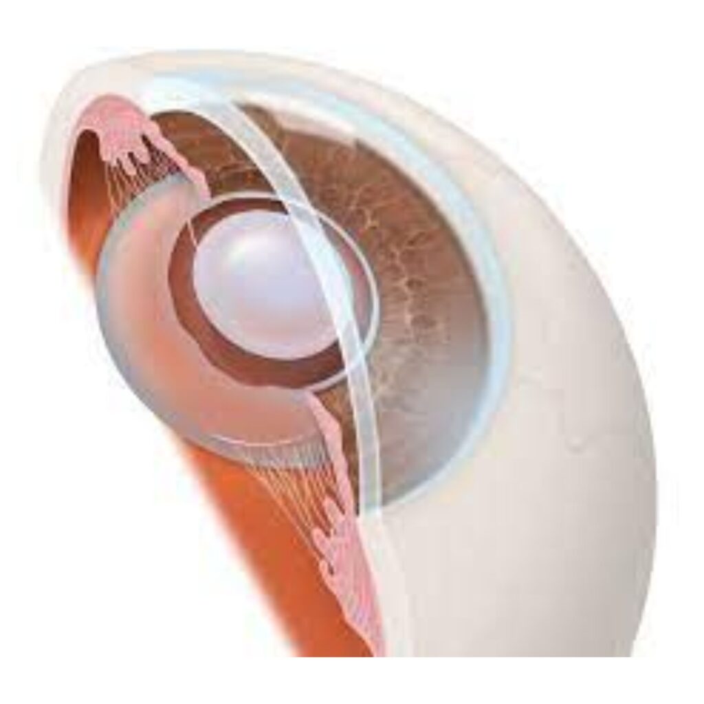 Cataract surgery in Anand Niketan using bladeless technique