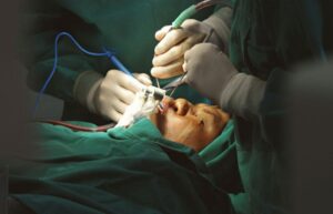 Top 5 Myths about Cataract Surgery: Busted