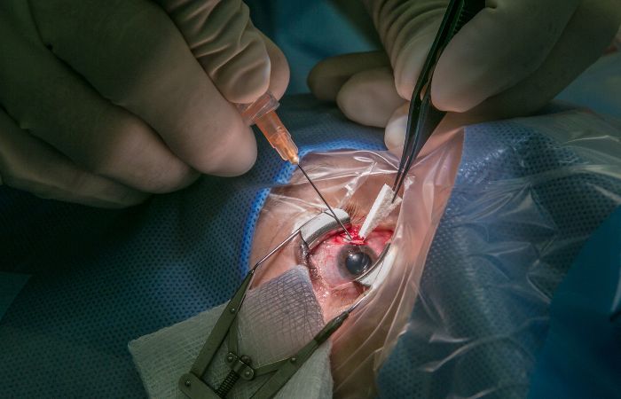 Clear Vision, Clear Life: How Modern Cataract Surgery is Transforming Lives