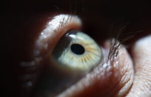 Gene Therapy for Retinal Dystrophy : Voretigene Neparvovec (Luxturna)