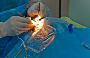 Comprehensive Guide to Cataract Surgery: Choosing the Best Surgeon, Hospital, Lens & Procedure