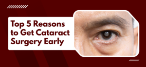 Top 5 Reasons to Get Cataract Surgery Early