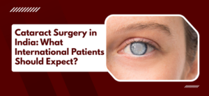 Cataract Surgery in India: What International Patients Should Expect?
