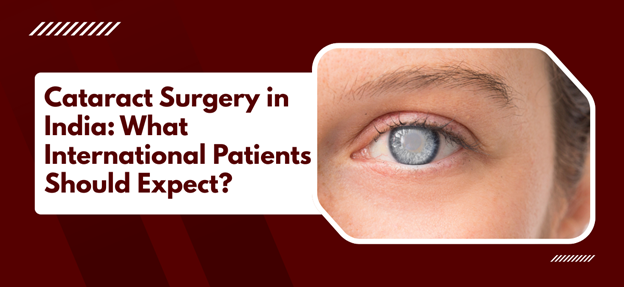 Cataract Surgery in India: What International Patients Should Expect?