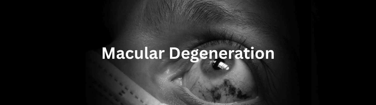 Grayscale close-up of a human eye with the title Macular Degeneration across the center.