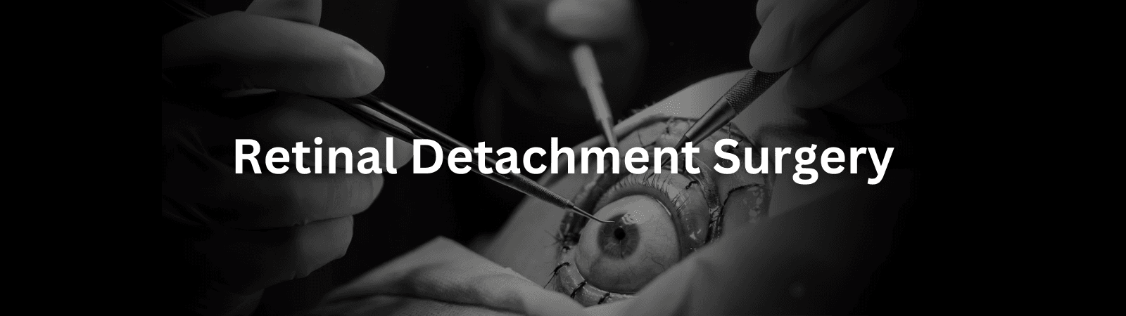Close-up of a surgeon performing retinal detachment surgery on a patient's eye, with instruments in use.