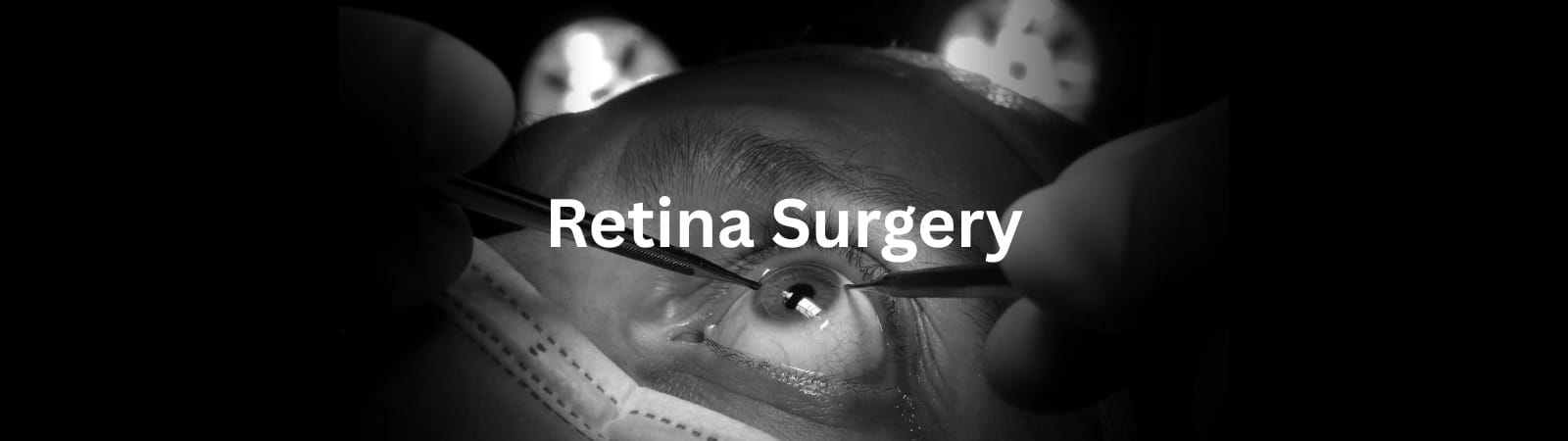 Close-up of an eye during retina surgery, with surgical instruments near the cornea and a masked patient nearby.