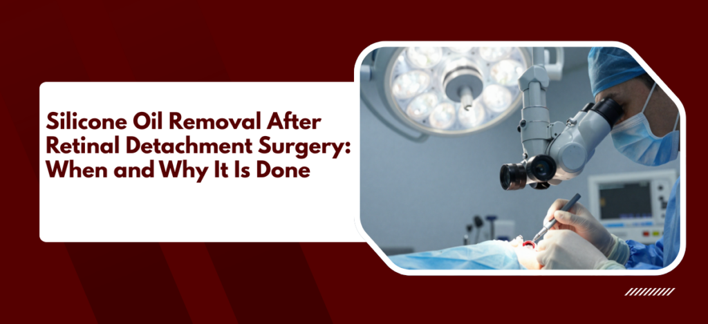 Informational banner: article title on silicone oil removal after retinal detachment surgery, with a surgeon operating under a microscope.