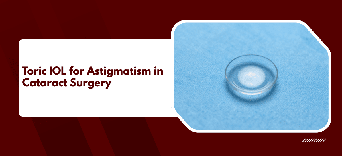 Toric IOL for Astigmatism in Cataract Surgery | Claritas Eye
