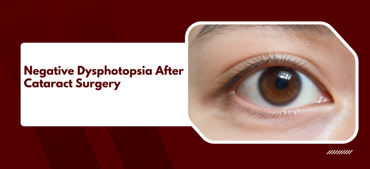 Negative Dysphotopsia After Cataract Surgery: Causes, Patient Experience, and Solutions