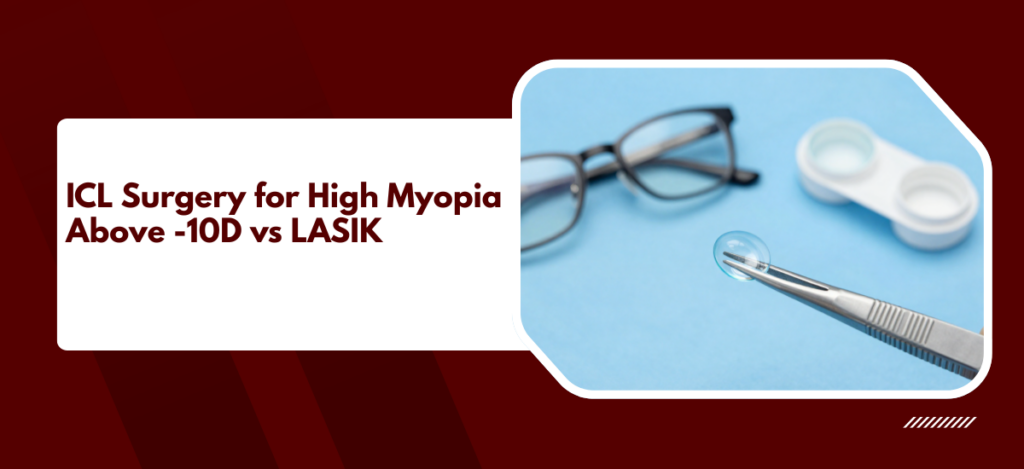 ICL surgery preserves corneal tissue and corrects myopia beyond LASIK's safe range.